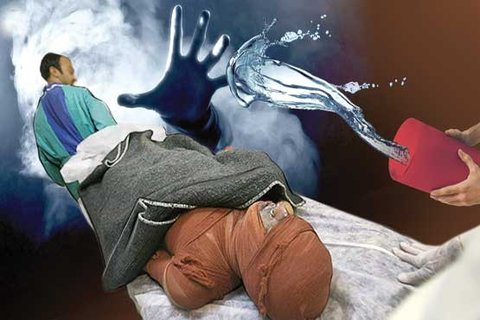 اسید پاشی در شهرضا موجب مصدومیت ۴ نفر از اعضای یک خانواده شد اسید پاشی