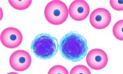 سه علامت  سرطان خون