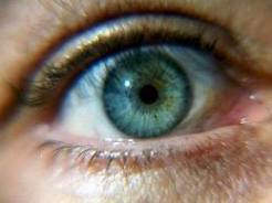 روش‌هایی برای از بین بردن حساسیت چشم به لنز 