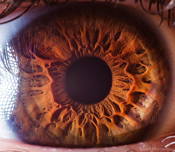 پدر چشم‌ پزشکی ایران: بیش از ۵۰ درصد بیماری‌های چشمی ناشی از مشکلات ژنتیکی است