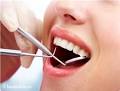 انجام خدمات دندانپزشکی برای دانش آموزان مناطق روستایی در خراسان شمالی