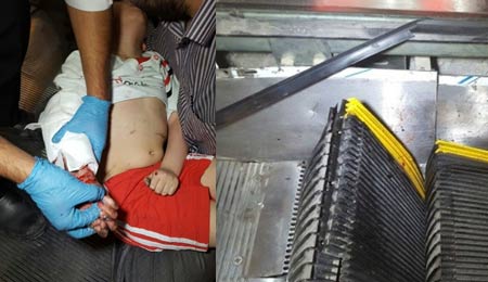 گیرکردن دست کودک مشهدی در پله برقی