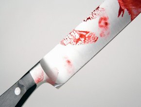 جوان ۳۰ ساله چاقو را به چشمان زن برادر خود فرو برد