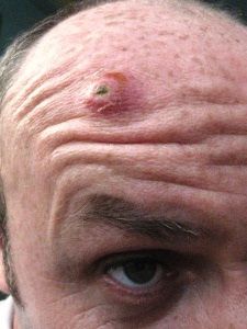 همه چیزهایی که درباره کورک ها باید بدانید