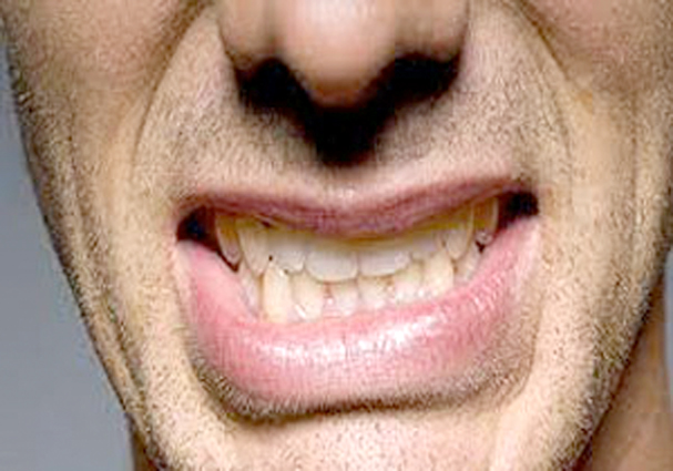  پیامهایی که «دندان‌ قروچه» براي شما دارد