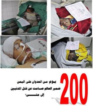 حدود ۷ هزار کشته و بیش ۱۴ هزار مجروح نتیجه تجاوز عربستان به یمن