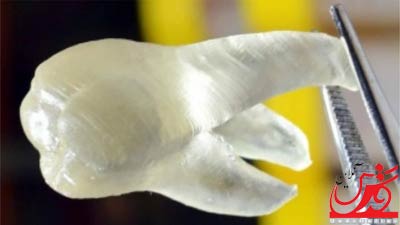 ایجاد دندان ضد باکتری با پرینتر سه بعدی