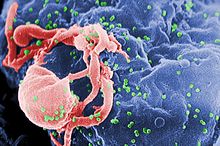 پروتئین بازدارنده ویروس ایدز کشف شد 