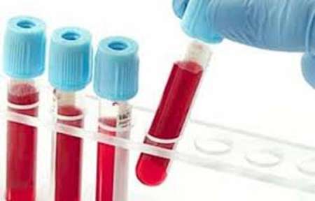 اطلاعات ژنتیکی ۴۸ هزار نمونه ذخیره در بانک خون بند ناف رویان استخراج شد