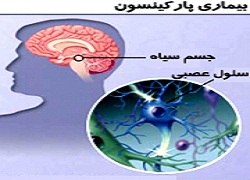 موفقیت ژن‌درمانی در بیماری پارکینسون 