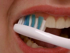  تاثیر بهداشت نامطلوب دهان و دندان بر سلامت بدن