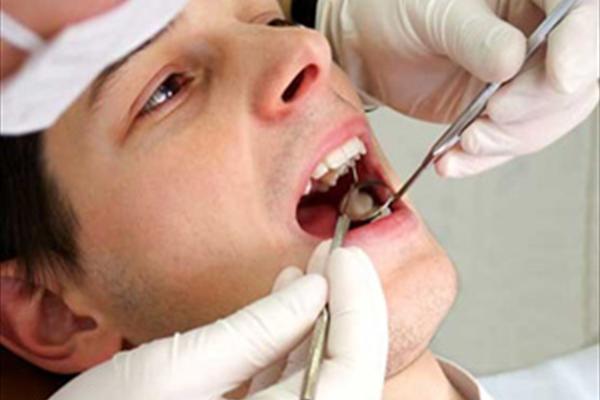     بدون نیاز به دندانپزشک دندان‌های خود را پرکنید
