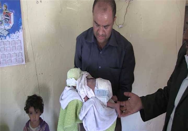 تولد کودکان یمنی با اختلال‌‌های مادرزادی + عکس