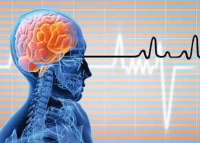 متخصص مغز و اعصاب: کرونا گاهی بدون هیچ علامتی مغز را درگیر می کند و بیمار دچار سکته مغزی می شود
