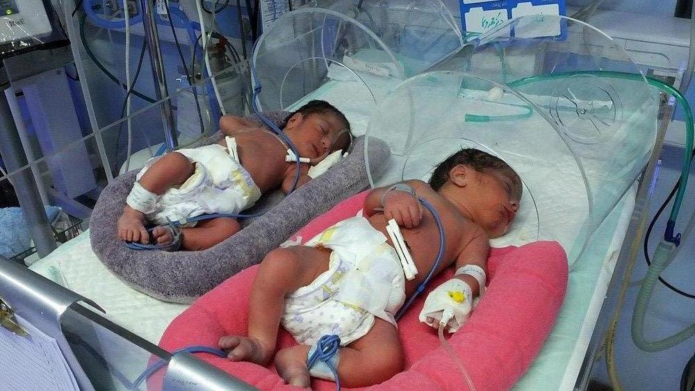 پیشگیری از تولد نوزادان نقص ایمنی اولیه در اصفهان