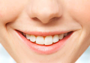 رنگ دندان‌ها در سلامت آنها موثر نیست 