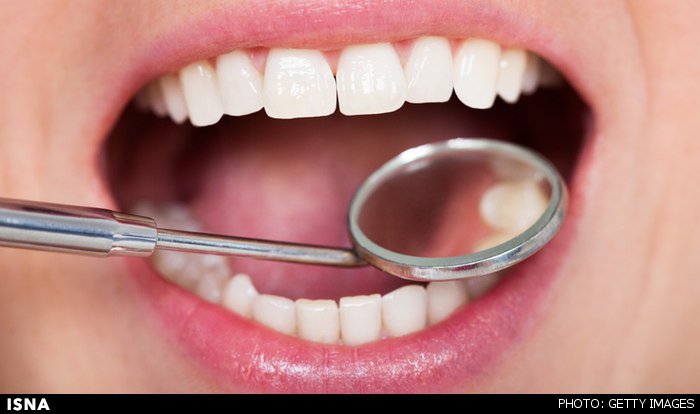 راهکارهایی برای جلوگیری از پوسیدگی دندان‌ها 