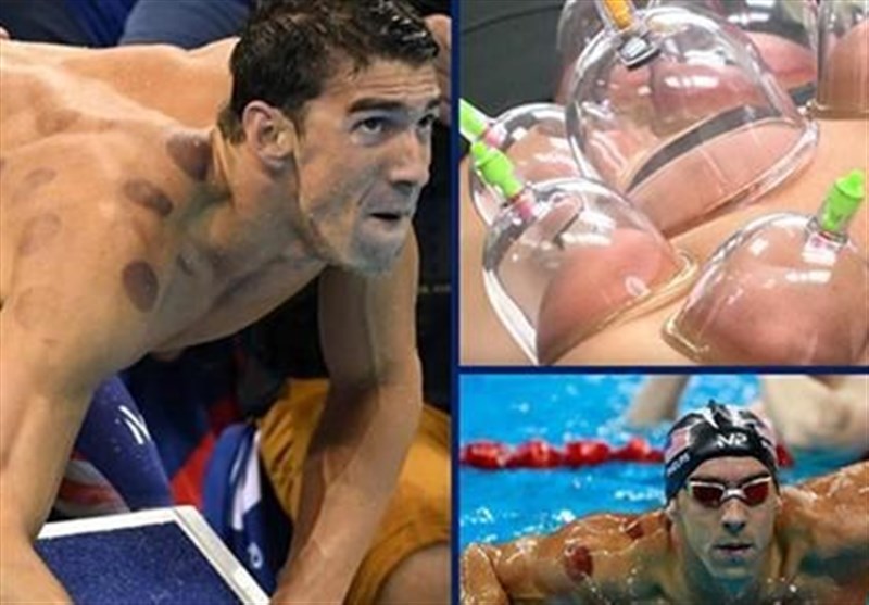  «بادکش‌» از رموز موفقیت اعجوبه «المپیک» در ریو + تصویر 