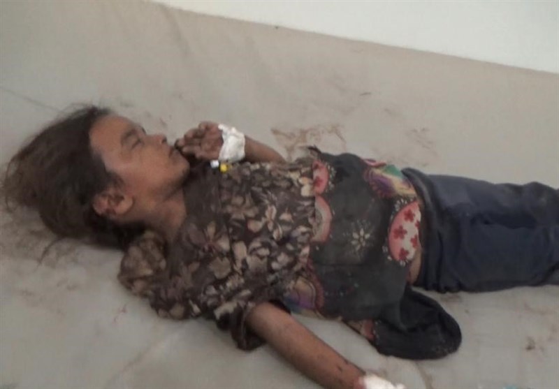 جنایت جدید عربستان در حجه یمن + تصاویر 