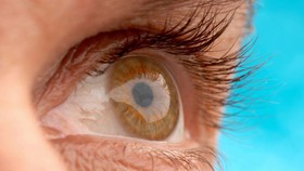 علل شایع خشکی چشم