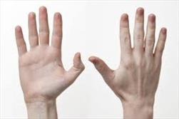 اثر انگشت یک نمونه مناسب برای آزمایش بالینی است