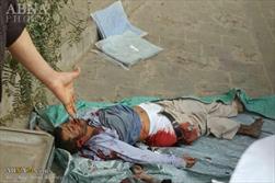 حمله مرگبار جنگنده های سعودی به شهر «حرض» یمن + تصاویر (۱۸+)