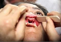 ویزیت رایگان بیش از ۹۰۰ بیمار ناهنجاری کام و دهان و جراحی ۱۲۰ نفر در سیستان وبلوچستان
