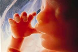 سقط جنین ناقص الخلقه و نامشروع+حکم شرعی 