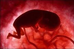 خطر سقط جنین با خوردن لبنیات