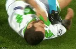 شکستگی دندان بازیکن وولفسبورگ مقابل رئال مادرید + عکس