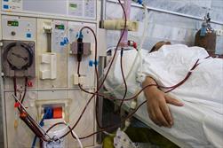 اختصاص ۶ دستگاه دیالیز به بیمارستان های خراسان شمالی
