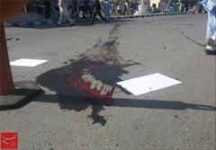تصاویر جدید از انفجار خونین کابل / مجروح شدن خبرنگار تسنیم