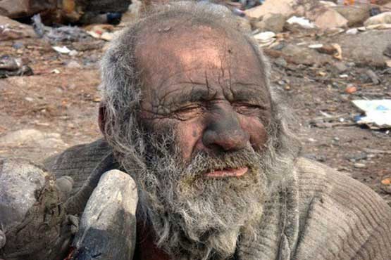 کثیف ترین مرد ایران سالم است+عکس
