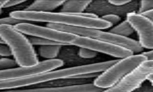 هشدار/ویروس مرگبار "ابولا"در راه است+عکس