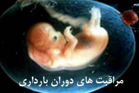 مرگ روزانه یک زن ایرانی به‌دلیل عوارض بارداری