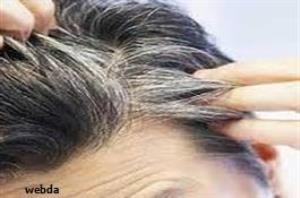 علت سفیدی زودرس مو چیست؟ 