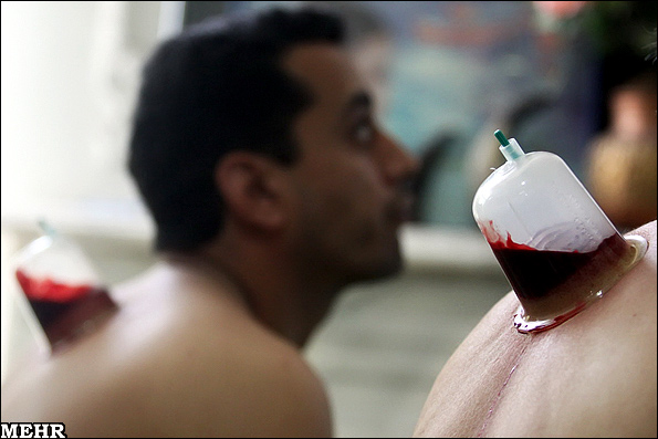 عملی که شفای 72 بیماری در آن نهفته است!