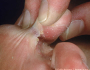 مراقب قلب دوم تان باشید!