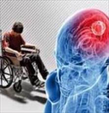 دارویی جدید برای ام اس به ثبت رسید
