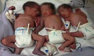 نوزادان ۳ قلو در تایباد متولد شدند