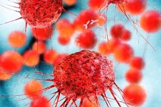 کروموزوم X دلیل ابتلا مردان به سرطان
