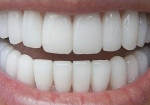 چرا دندانها «لق» می‌شوند / ویژگی‌ مسواک خوب