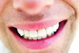 بهترین روش جایگزینی برای دندان‌های از دست رفته چیست ؟
