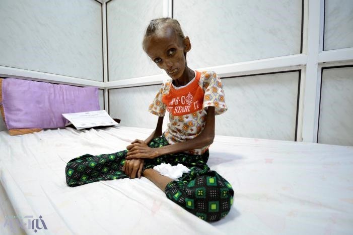 مرگ میلیون‌ها یمنی در «جنگ فراموش شده» + تصاویر