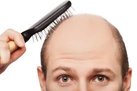 از درمان خودسرانه ریزش موهایتان دست بردارید