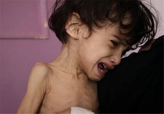 سازمان ملل: ۱۴ میلیون در یمن از کمبود غذا رنج می‎برند