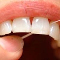بهترین راه پیشگیری از پوسیدگی دندان