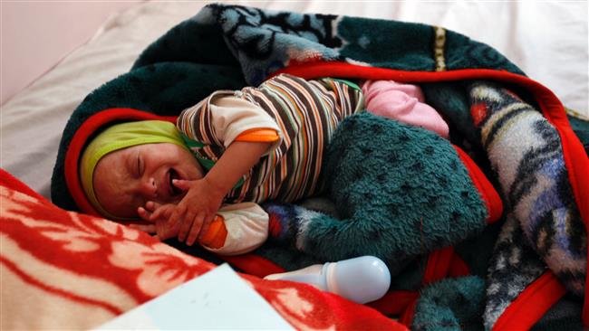 یونیسف: 2.2 میلیون کودک یمنی دچار سوءتغذیۀ حاد هستند
