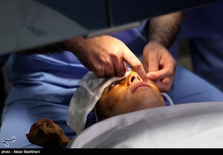 شبکیه چشم قربانی ثمره تاخیر مراجعات چشم پزشکی