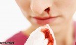چگونه خون دماغ را بند بیاوریم؟
